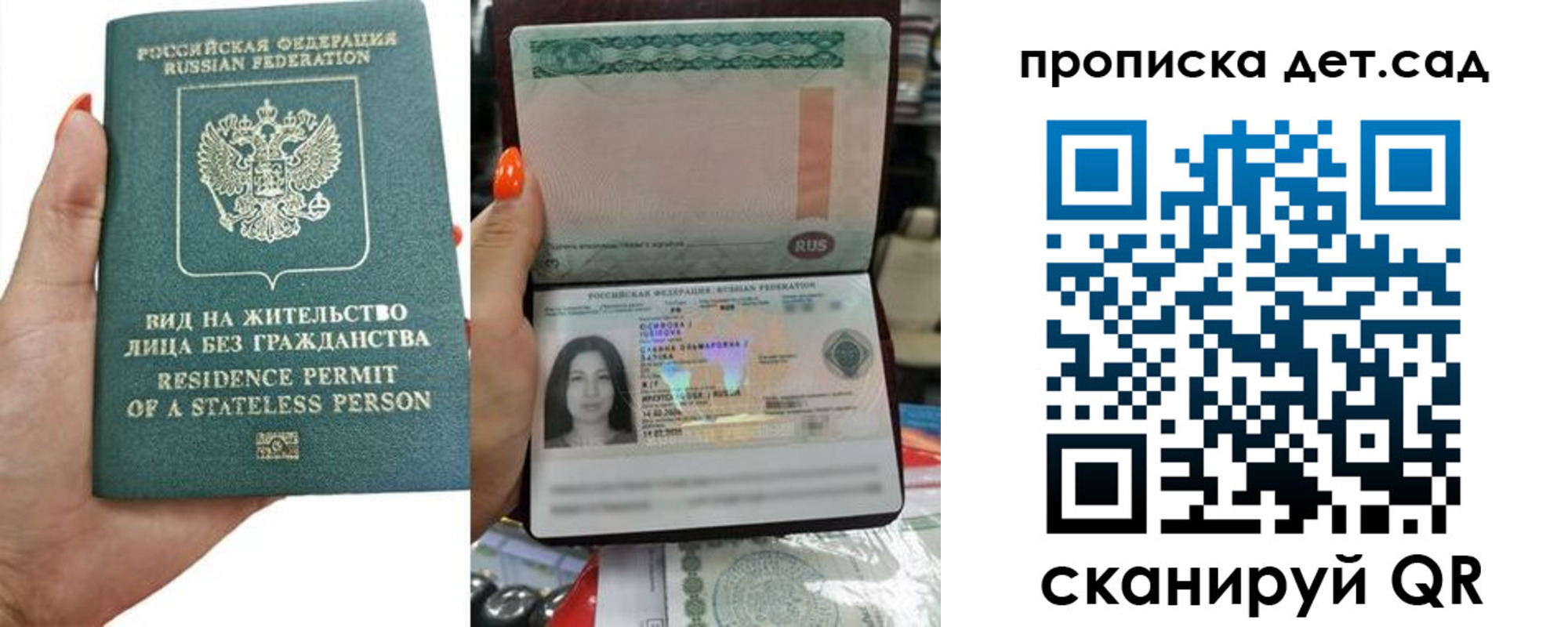 прописка в Кондопоге